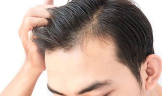 Haartransplantation